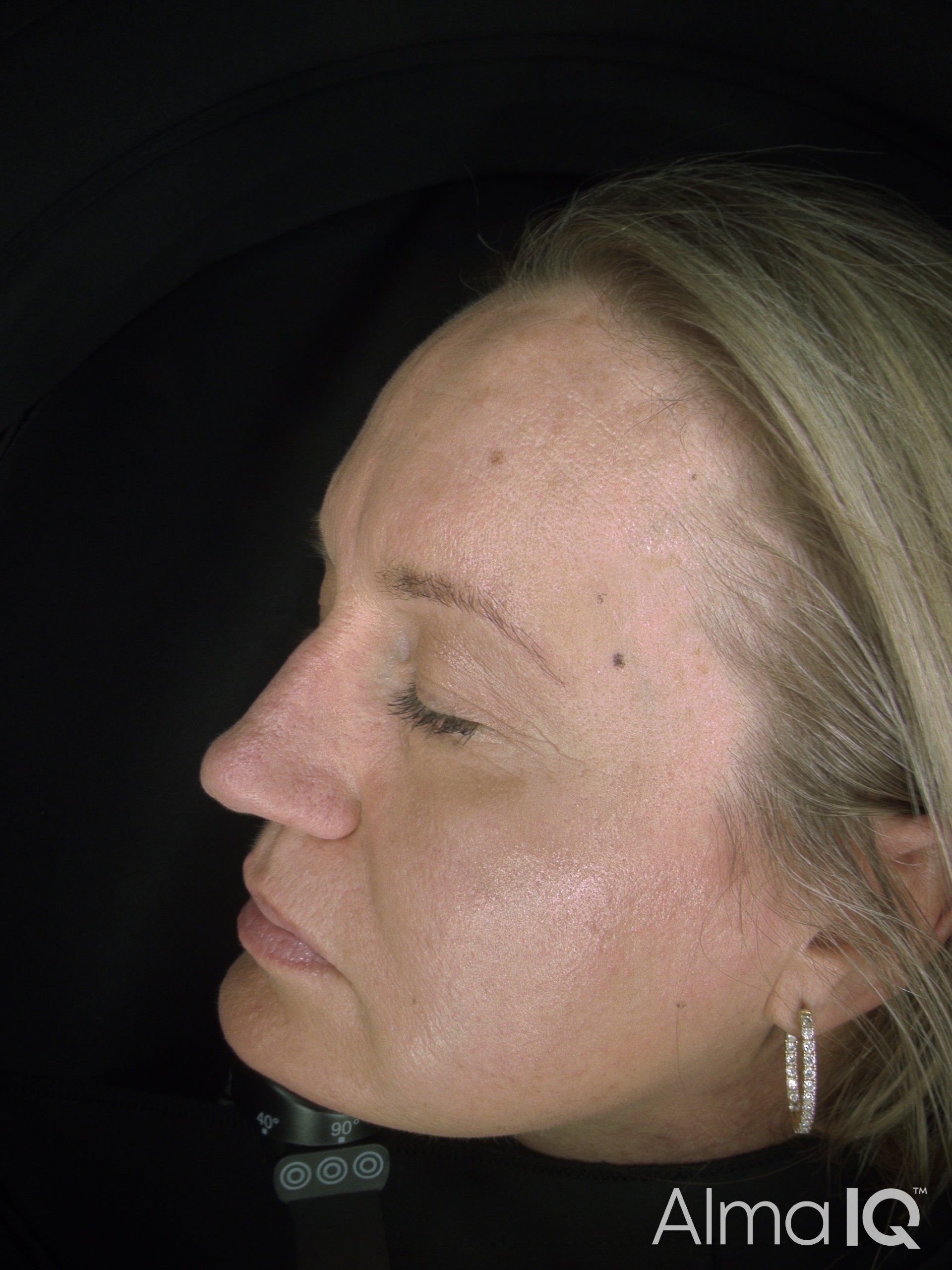 Sarah After Side Daylight