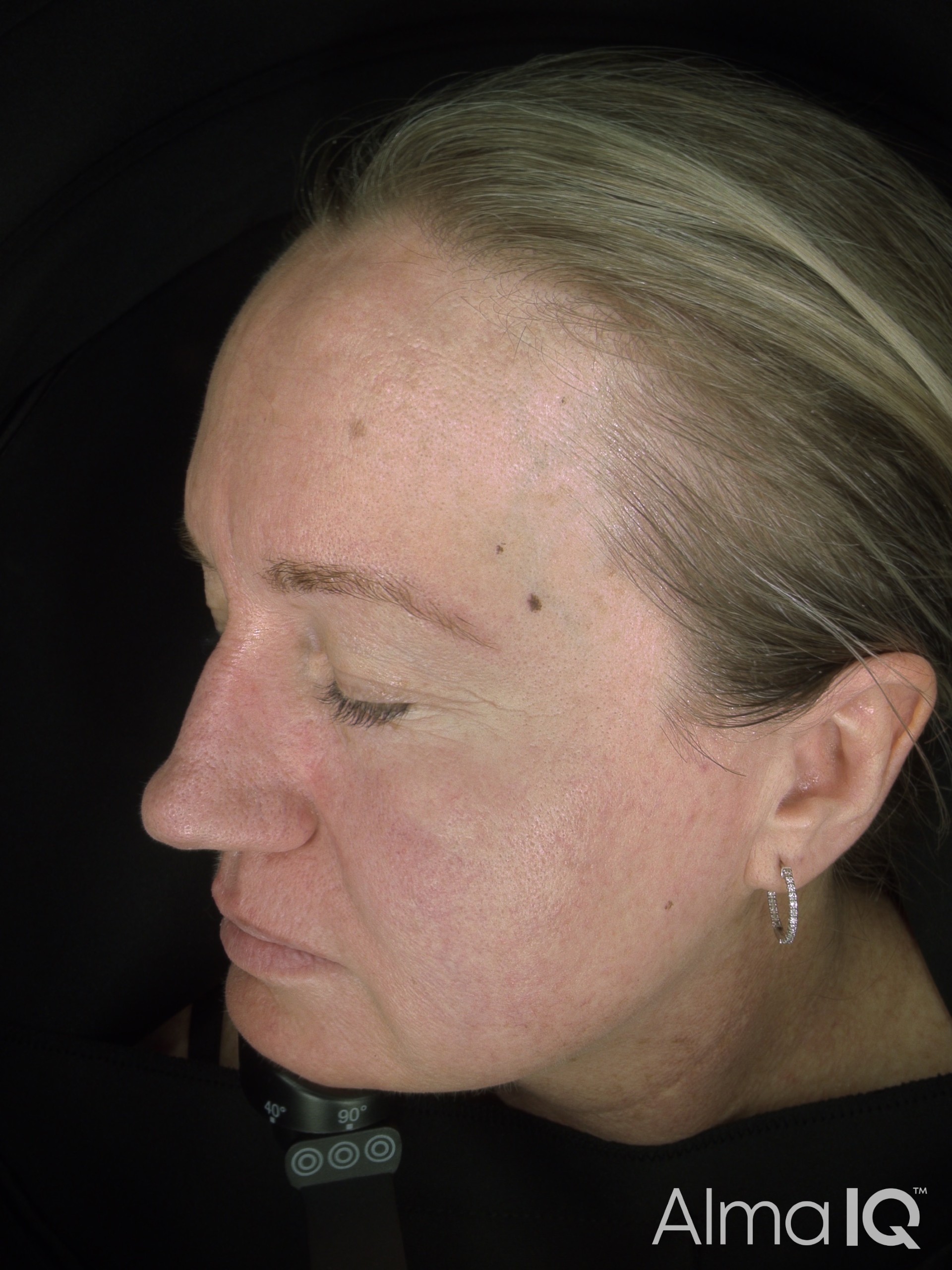 Sarah Before Side Daylight