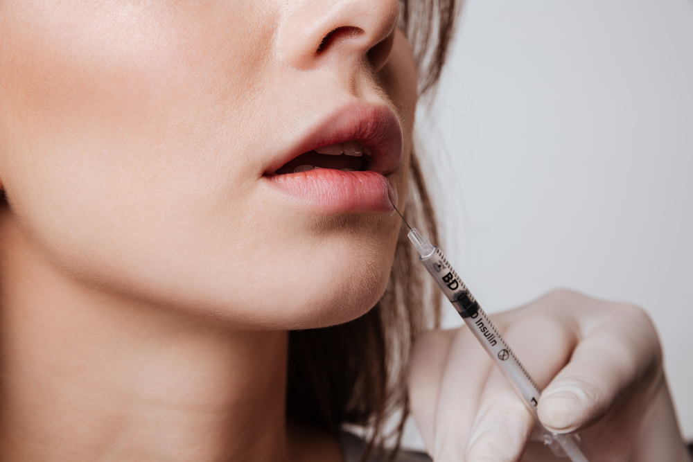 5 Must-Know Tips to Find the Best Lip Filler Injector Near New Philadelphia, Ohio